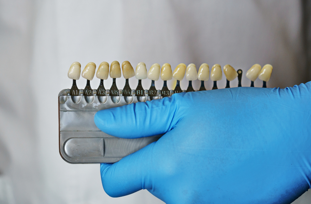 blanqueamiento dental