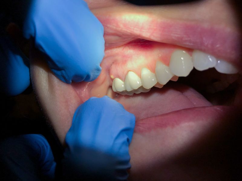 cuando acudir a una urgencia dental