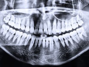 radiografía panorémica