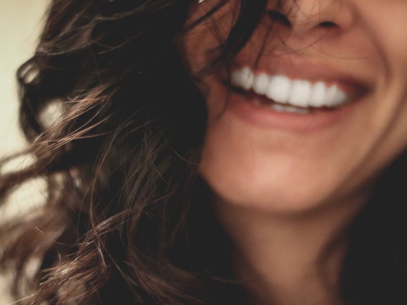mujer sonriendo, estética orofacial