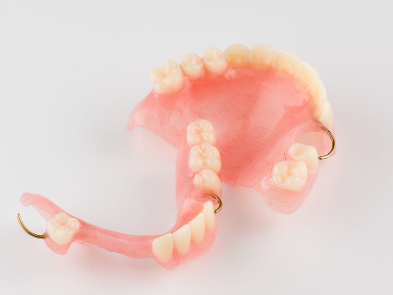 prótesis dentales