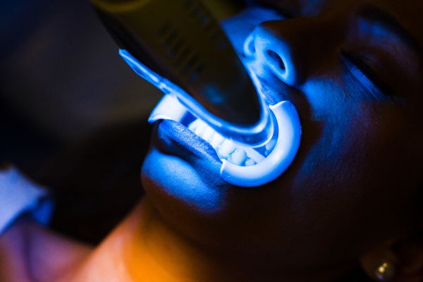 estética dental