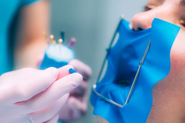 diente después de una endodoncia