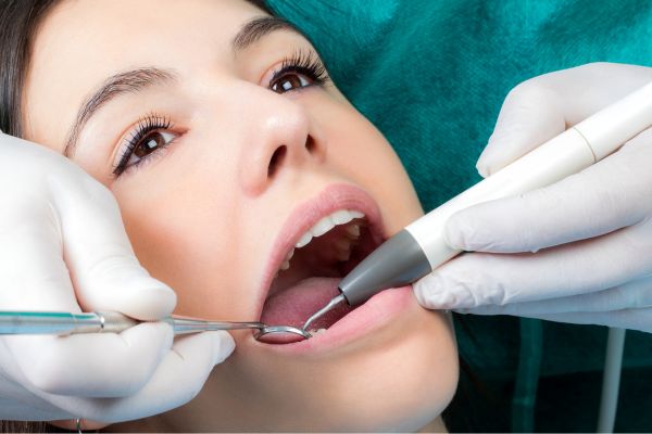 hemorragia dental