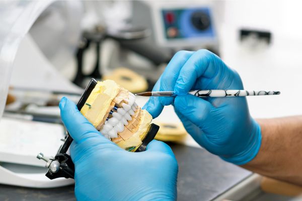 reemplazar una prótesis dental