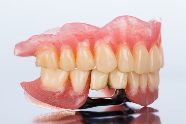 reemplazar una prótesis dental