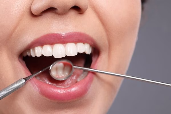 Halitosis