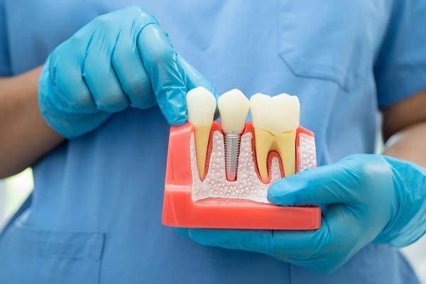 periimplantitis